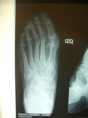 Radiografia pre operat�ria